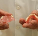Порядок протезирования зубов