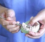 Новое в протезировании зубов