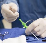 В Вильнюсе впервые в мире сделана уникальная операция на сердце