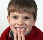 Ребенок выбил зуб. Что делать?