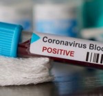 В Литве подтвержден 581 случай заражения коронавирусом
