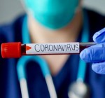 За сутки подтверждено 15 новых случаев коронавируса, общее число – 1562