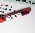 За сутки подтверждено 16 новых случаев коронавируса, общее число – 1593 (уточнения)