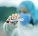 За сутки подтверждено 32 новых случая коронавируса и один смертельный исход