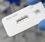 ЕК должна завершить процедуру закупки быстрых тестов на антитела в конце января