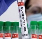 Минздрав: в ближайшие две недели в Литву поступят 700 вакцин от оспы обезьян