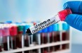 В Литву поступили 100,2 тыс. доз вакцины от коронавируса, адаптированной к омикрону