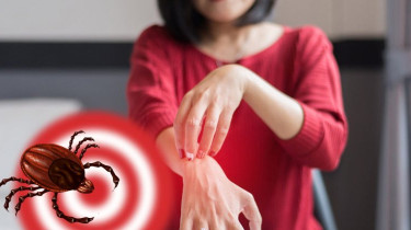 5–7 сентября можно провериться на болезнь Лайма