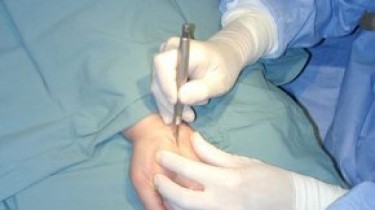 В Германии проведена уникальная операция по пересадке рук