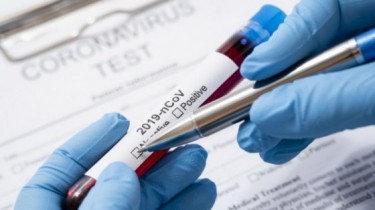 Выявлены еще 24 новых случая коронавируса в Литве, общее число – 484