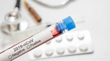 За сутки в Литве подтверждены 6 новых случаев коронавируса, общее число – 1720