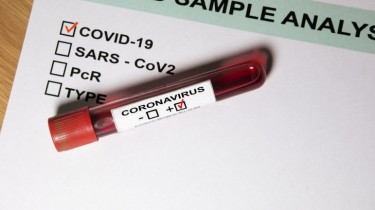 За минувшие сутки В Литве подтверждено 5 новых случаев коронавируса, общее количество - 1768