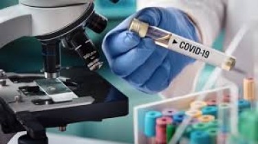 За минувшие сутки установлено 80 новых случаев коронавируса