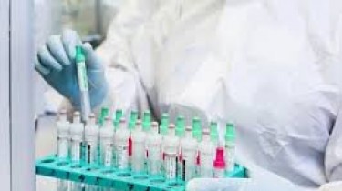 За минувшие сутки в Литве выявлено 3934 новых случая коронавируса, скончались 75 человек