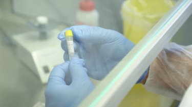 Подписан договор о приобретении 300 тыс. быстрых антигенных тестов на COVID-19