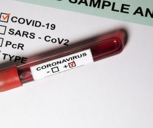 За сутки подтверждено 16 новых случаев коронавируса, общее число – 1593 (уточнения)