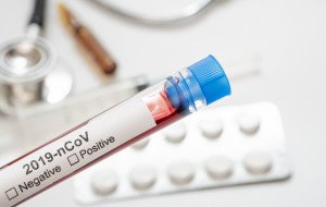 За сутки в Литве подтверждены 6 новых случаев коронавируса, общее число – 1720