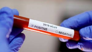 За сутки подтверждено 17 новых случаев коронавируса, общее число – 3100